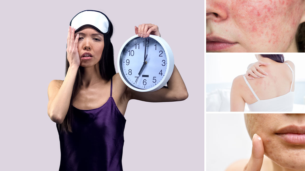 عواقب کمبود خواب برای پوست و تاثیر خواب بر سلامت پوست