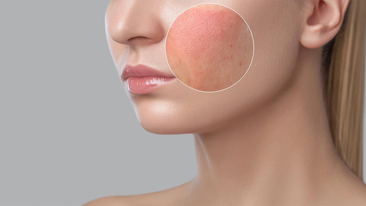 راهکارهای عملی برای کاهش و درمان حساسیت پوستی