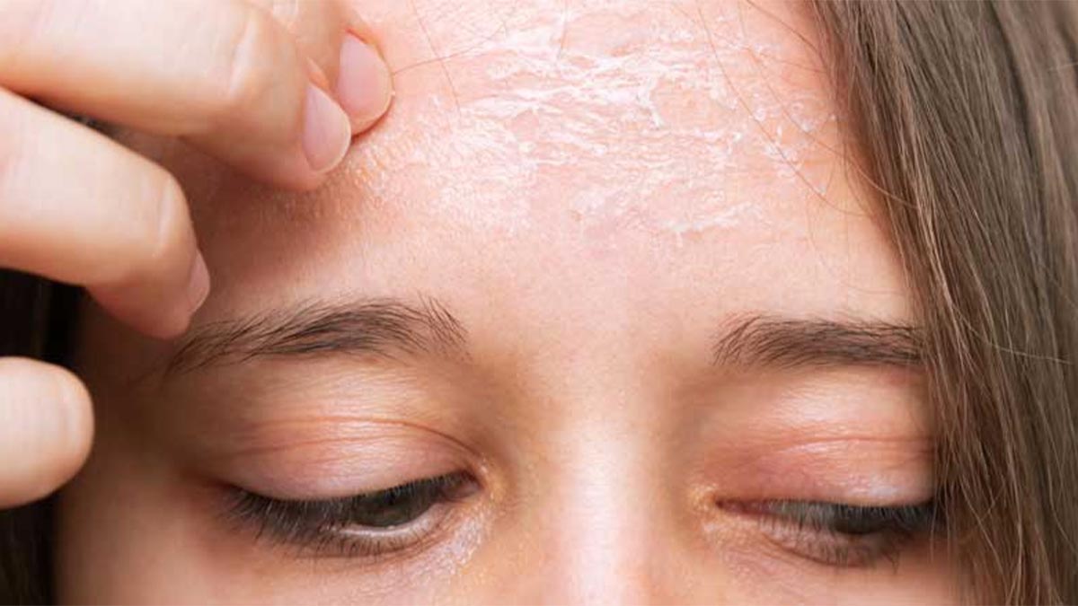 شناخت علل حساسیت پوستی