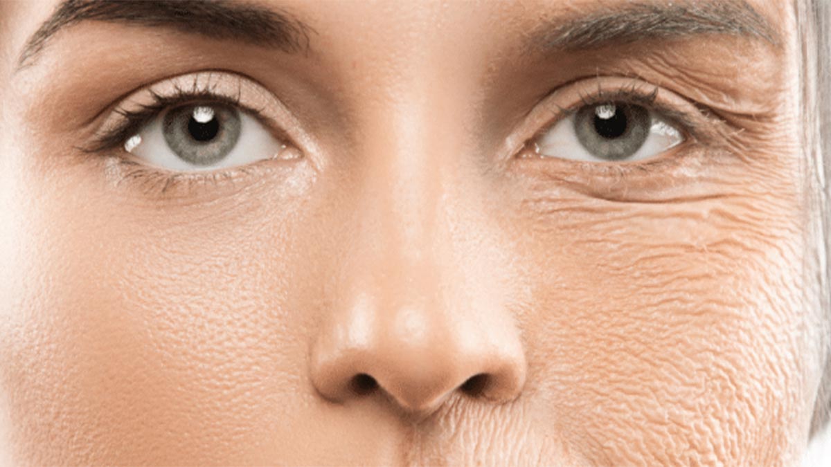 عوامل مؤثر بر ایجاد خطوط ریز صورت