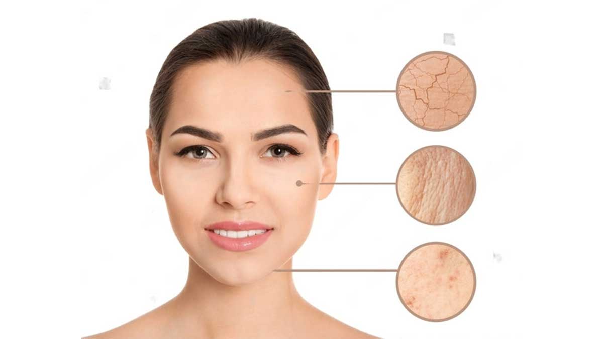 انواع جنس پوست و ویژگی‌های آن‌ها