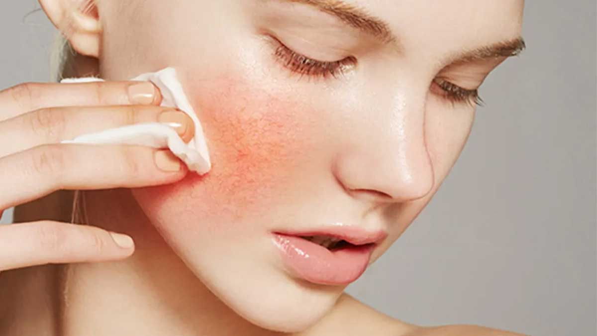 بررسی موانع بازسازی پوست + ارائه راه حل تخصصی