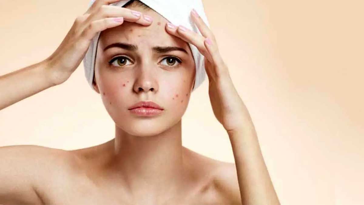 عوامل محیطی و سبک زندگی، دشمنان پنهان پوست