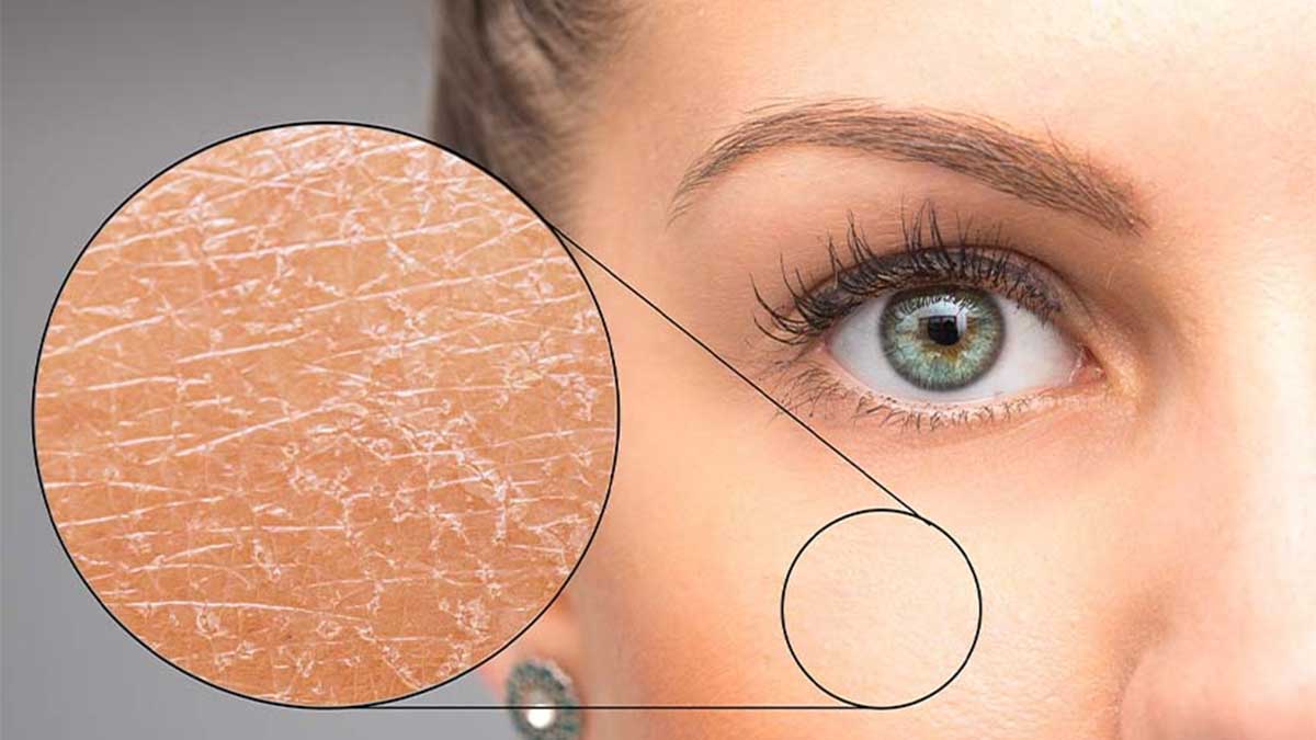 موانع بازسازی پوست، عوامل داخلی و بیولوژیکی