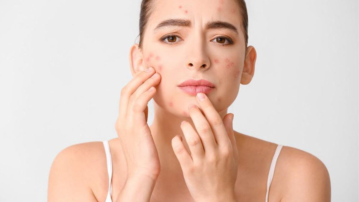 دلایل اصلی لک صورت