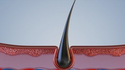راهکارهای تقویت ساختار مو