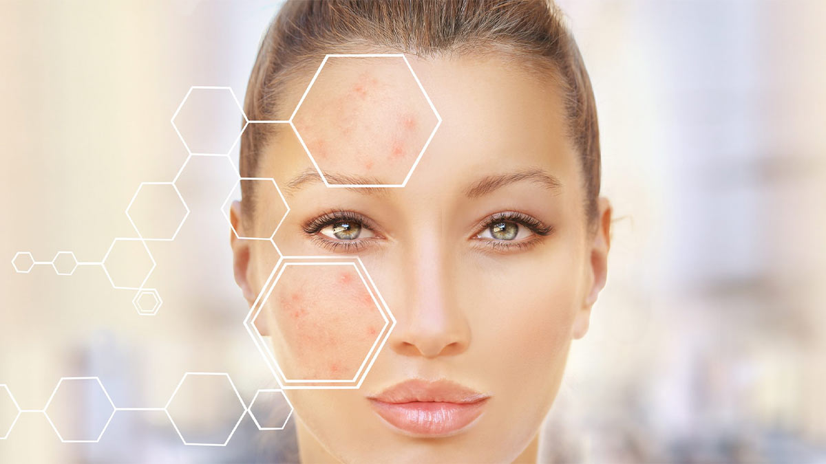 مشکلات ناشی از عدم تعادل پی اچ پوست و راه‌حل‌ها