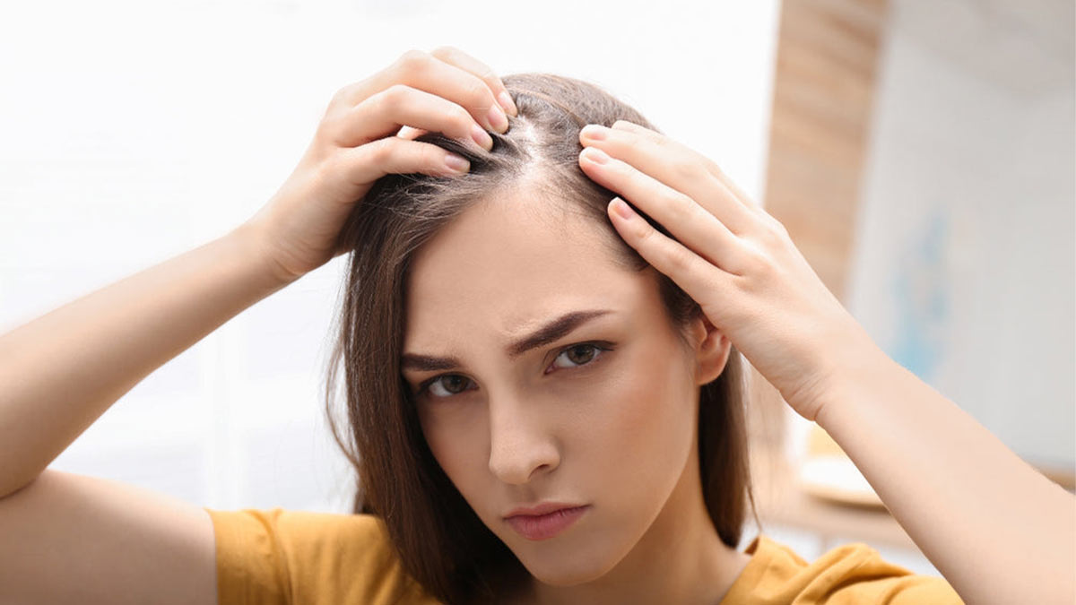 از کجا بفهمیم ریزش مو هورمونی است؟