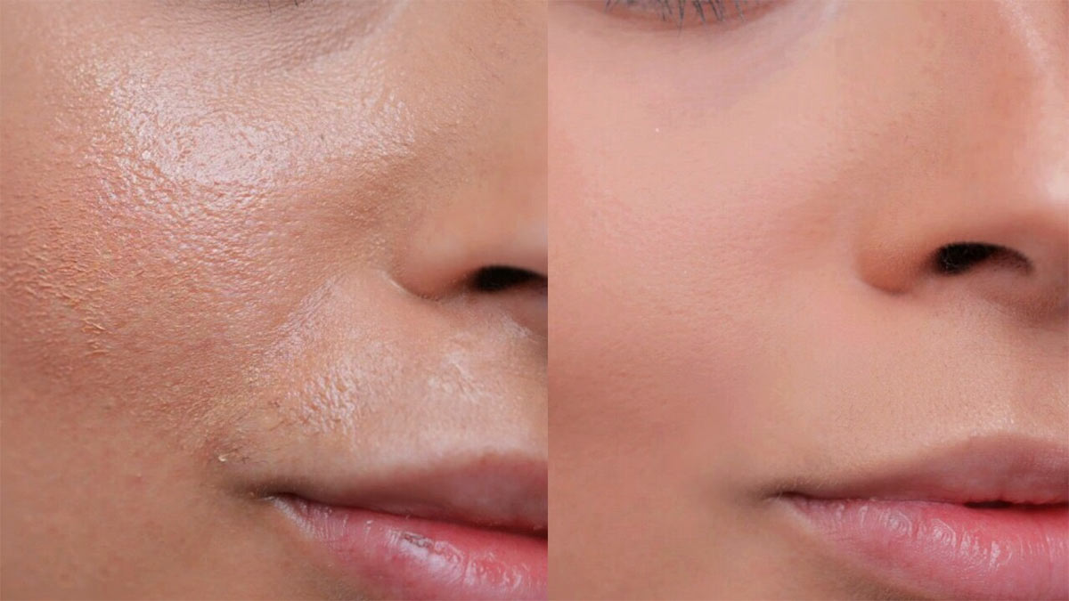 دلایل چرب شدن پوست بعد از آرایش + راهکارهای اصولی