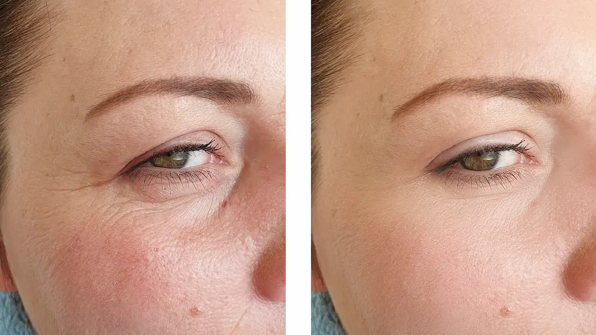 رتینول چیست و چرا برای پوست شما ضروری است؟