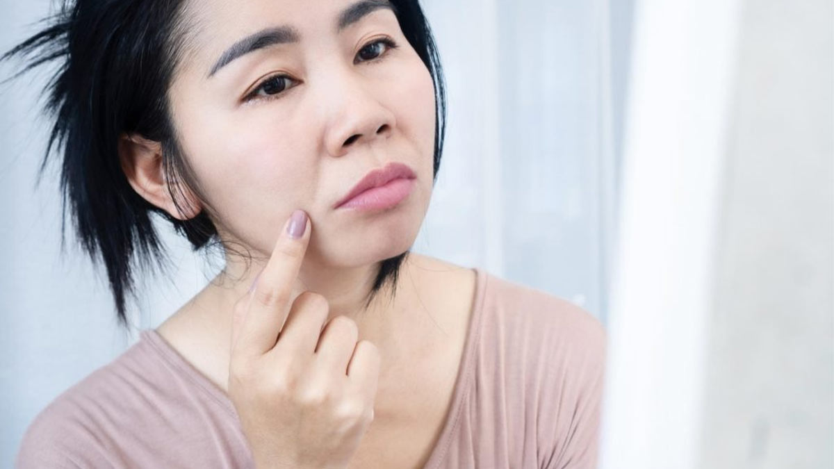 علل و عوامل ایجاد خط خنده