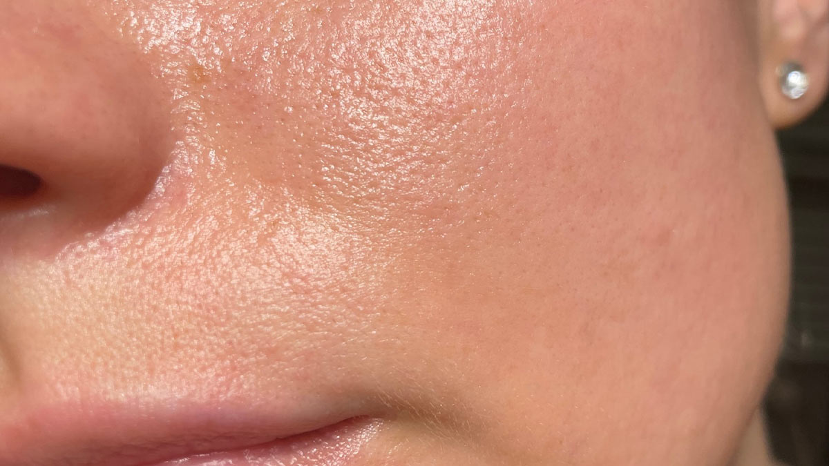 مکانیسم‌های بیولوژیکی چرب شدن پوست پس از آرایش