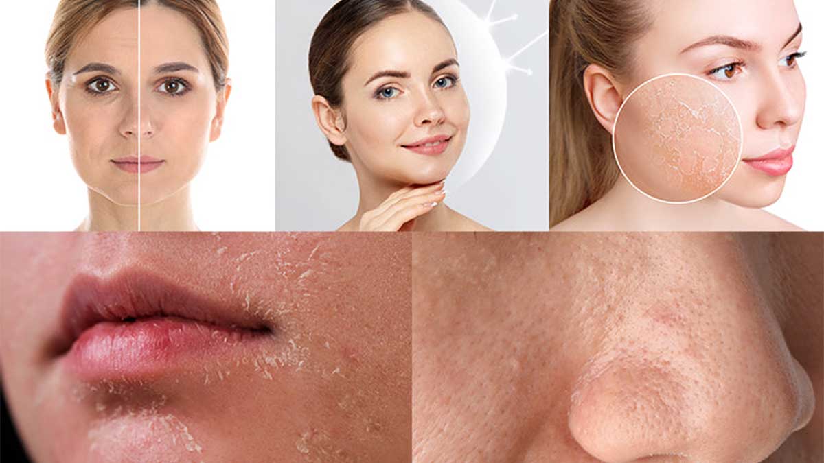 آبرسان چیست و چگونه کار می‌کند؟