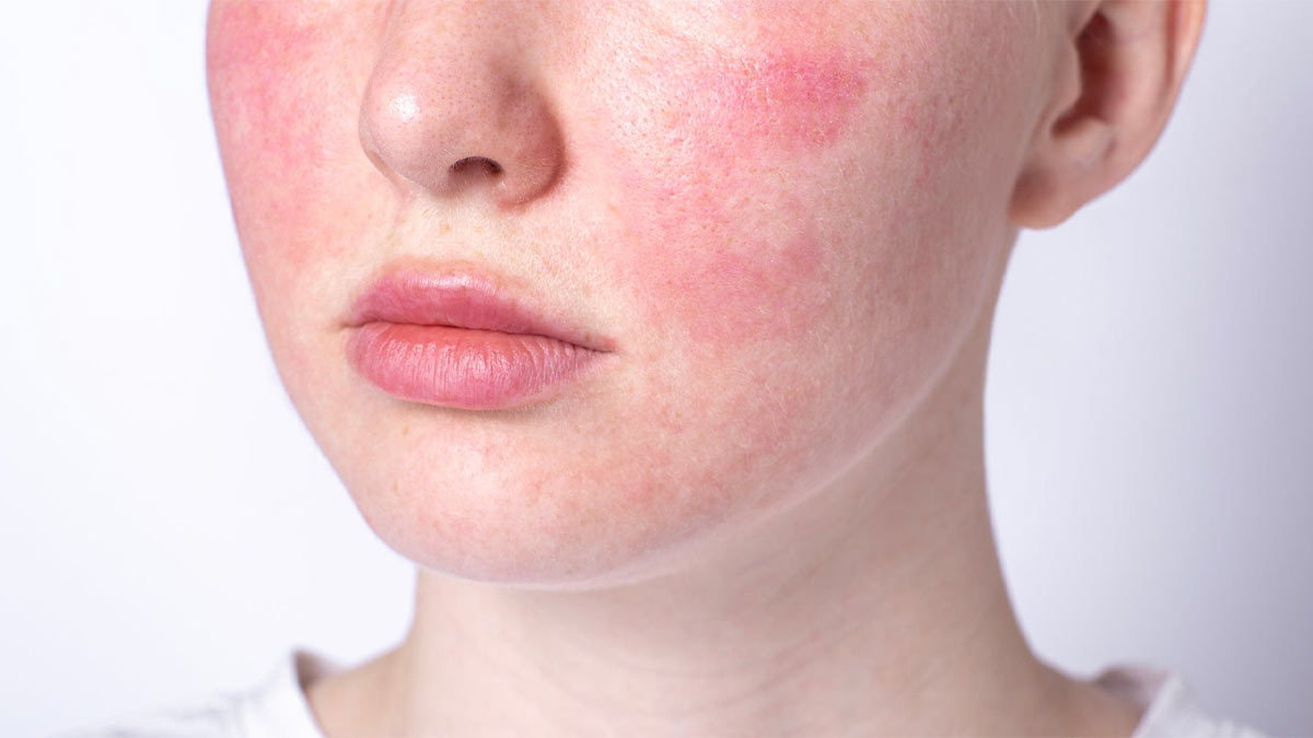 درک پوست حساس و اهمیت روتین مراقبتی مناسب