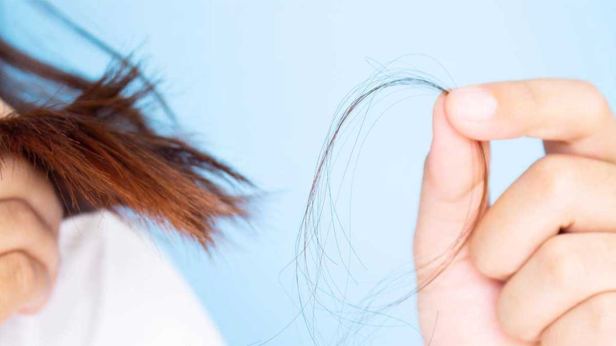 عوامل موثر در ریزش مو
