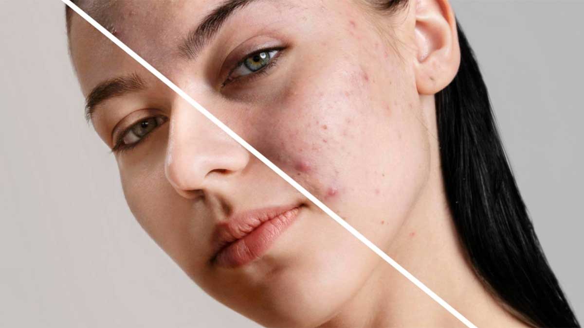 ویژگی‌های انواع پوست و نشانه‌های کلیدی آنها